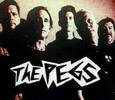 The Pegs