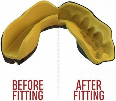 Hockey Mouth Guard Safe Jawz Extro Series Self-Fit Goldie SR UNI Hockey Mouth Guard - 3