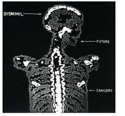 Vinyl Record Disnihil - Future Cancers (LP) - 1