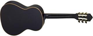Classical guitar Ortega R221BK Premium SET Black Classical guitar - 2