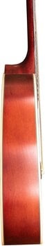 Akustická kytara SX SD204 Basic SET Transparent Red Akustická kytara - 4