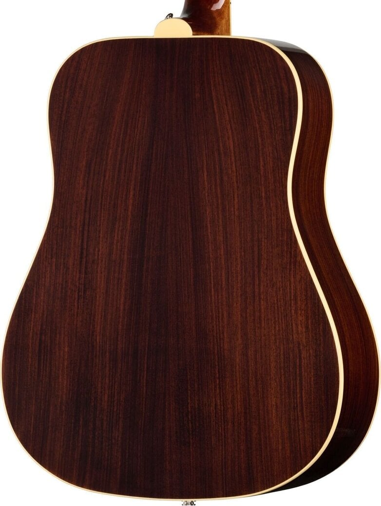 Fretboard