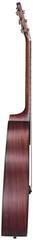Akustikgitarre Baton Rouge X11LS/F-W-SCR Crimson Akustikgitarre - 2