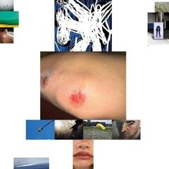 Грамофонна плоча Remo Helfenstein - Spite (LP)