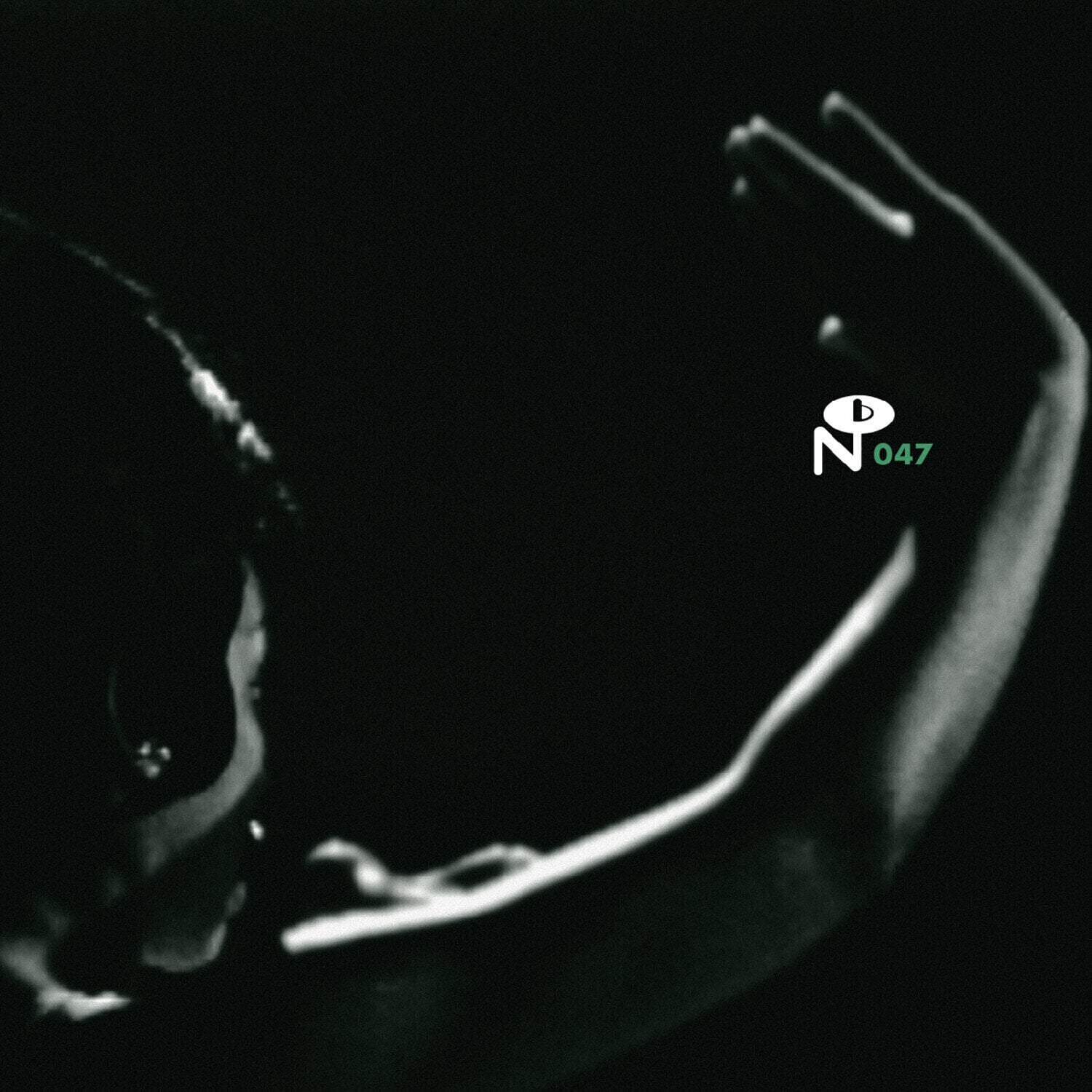 Disco de vinil Various Artists - Eccentric Soul: The Forte Label (Tear Drops Blue Coloured) (2 LP)