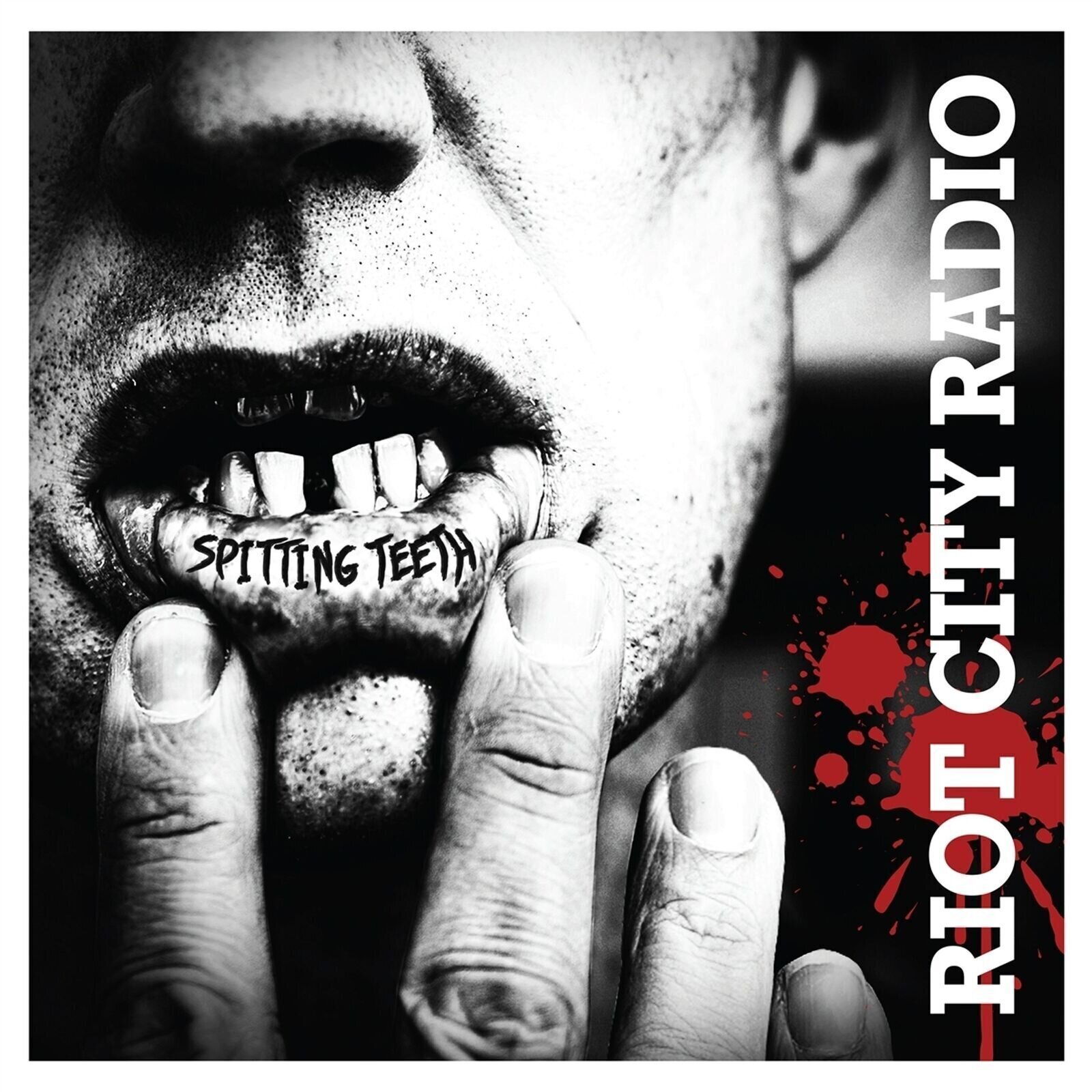 LP ploča Riot City Radio - Spitting Teeth (Limited Edition) (LP)
