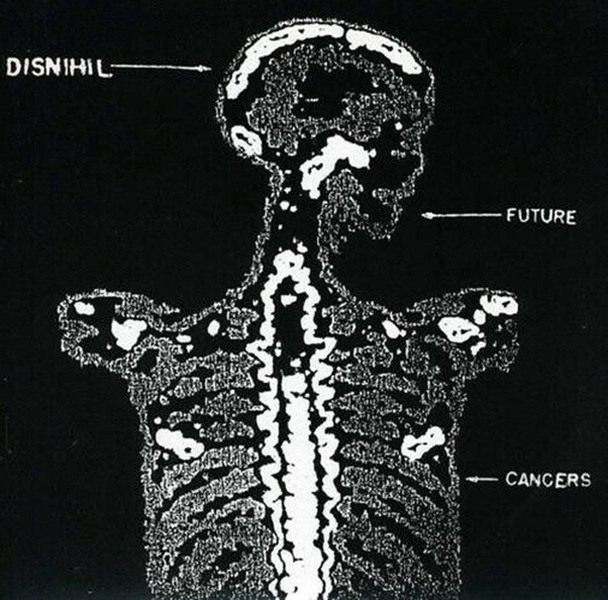 Vinyl Record Disnihil - Future Cancers (LP)