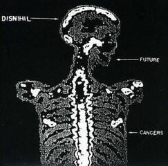 Vinyl Record Disnihil - Future Cancers (LP)