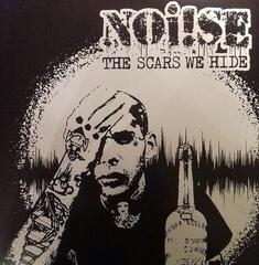 LP ploča Noi!Se - The Scars We Hide (Reissue) (LP)